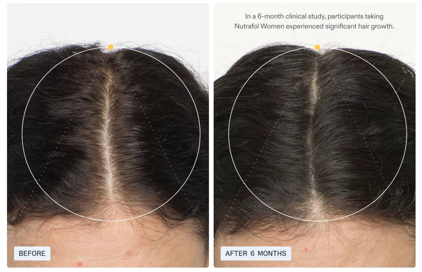 Nutrafol Women Hair Growth Supplement 6-Month Supply | Ex